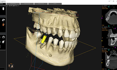歯科用CTによる正確な診査・診断